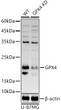 Western blot analysis of lysates from wild type (WT) and GPX4 knockdown (KD) U-87MG cells, using [KD Validated] GPX4 Rabbit polyclonal antibody (STJ11104345) at 1:1000 dilution. Secondary antibody: HRP Goat Anti-Rabbit IgG (H+L) (STJS000856) at 1:10000 dilution. Lysates/proteins: 25 Mu g per lane. Blocking buffer: 3% nonfat dry milk in TBST. Detection: ECL Basic Kit. Exposure time: 30s.