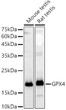 Western blot analysis of various lysates using [KD Validated] GPX4 Rabbit polyclonal antibody (STJ11104345) at 1:1000 dilution. Secondary antibody: HRP Goat Anti-Rabbit IgG (H+L) (STJS000856) at 1:10000 dilution. Lysates/proteins: 25 Mu g per lane. Blocking buffer: 3% nonfat dry milk in TBST. Detection: ECL Basic Kit. Exposure time: 1s.