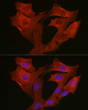 Immunofluorescence analysis of NIH/3T3 cells using MyD88 Rabbit polyclonal antibody (STJ11104377) at dilution of 1:200 (40x lens). Blue: DAPI for nuclear staining.