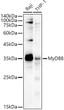 Western blot analysis of extracts of various cell lines, using MyD88 antibody (STJ11104377) at 1:1000 dilution. Secondary antibody: HRP Goat Anti-Rabbit IgG (H+L) (STJS000856) at 1:10000 dilution. Lysates/proteins: 25 Mu g per lane. Blocking buffer: 3% nonfat dry milk in TBST. Detection: ECL Basic Kit. Exposure time: 30s.