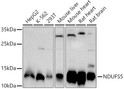 Western blot analysis of extracts of various cell lines, using NDUFS5 antibody (STJ11104383) at 1:1000 dilution. Secondary antibody: HRP Goat Anti-Rabbit IgG (H+L) (STJS000856) at 1:10000 dilution. Lysates/proteins: 25 Mu g per lane. Blocking buffer: 3% nonfat dry milk in TBST. Detection: ECL Basic Kit. Exposure time: 90s.