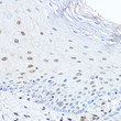 Immunohistochemistry analysis of PAX3 in paraffin-embedded human esophageal using PAX3 Rabbit polyclonal antibody (STJ11104390) at dilution of 1:100 (40x lens). Perform high pressure antigen retrieval with 10 mM citrate buffer pH 6. 0 before commencing with immunohistochemistry staining protocol.