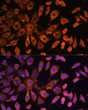 Immunofluorescence analysis of L929 cells using [KO Validated] Bcl-2 Rabbit polyclonal antibody (STJ11104432) at dilution of 1:100. Secondary antibody: Cy3 Goat Anti-Rabbit IgG (H+L) at 1:500 dilution. Blue: DAPI for nuclear staining.