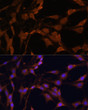 Immunofluorescence analysis of C6 cells using [KO Validated] Bcl-2 Rabbit polyclonal antibody (STJ11104432) at dilution of 1:100. Secondary antibody: Cy3 Goat Anti-Rabbit IgG (H+L) at 1:500 dilution. Blue: DAPI for nuclear staining.
