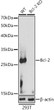 Western blot analysis of lysates from wild type (WT) and Bcl-2 knockout (KO) 293T cells, using [KO Validated] Bcl-2 Rabbit polyclonal antibody (STJ11104432) at 1:1000 dilution. Secondary antibody: HRP Goat Anti-Rabbit IgG (H+L) (STJS000856) at 1:10000 dilution. Lysates/proteins: 25 Mu g per lane. Blocking buffer: 3% nonfat dry milk in TBST. Detection: ECL Basic Kit. Exposure time: 30s.