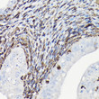 Immunohistochemistry analysis of Vimentin in paraffin-embedded rat uterus using Vimentin Rabbit polyclonal antibody (STJ11104460) at dilution of 1:100 (40x lens). Perform high pressure antigen retrieval with 10 mM citrate buffer pH 6. 0 before commencing with immunohistochemistry staining protocol.