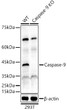 Western blot analysis of lysates from wild type (WT) and Caspase-9 Rabbit polyclonal antibody knockout (KO) 293T cells, using [KO Validated] Caspase-9 Rabbit polyclonal antibody (STJ11104477) at 1:500 dilution. Secondary antibody: HRP Goat Anti-Rabbit IgG (H+L) (STJS000856) at 1:10000 dilution. Lysates/proteins: 25 Mu g per lane. Blocking buffer: 3% nonfat dry milk in TBST. Detection: ECL Basic Kit. Exposure time: 180s.