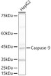 Western blot analysis of lysates from HepG2 cells, using [KO Validated] Caspase-9 Rabbit polyclonal antibody (STJ11104477) at 1:500 dilution. Secondary antibody: HRP Goat Anti-Rabbit IgG (H+L) (STJS000856) at 1:10000 dilution. Lysates/proteins: 25 Mu g per lane. Blocking buffer: 3% nonfat dry milk in TBST. Detection: ECL Basic Kit. Exposure time: 180s.