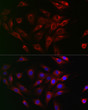 Immunofluorescence analysis of NIH/3T3 cells using [KO Validated] Beclin 1 Rabbit polyclonal antibody (STJ11104484) at dilution of 1:200 (40x lens). Secondary antibody: Cy3 Goat Anti-Rabbit IgG (H+L) at 1:500 dilution. Blue: DAPI for nuclear staining.