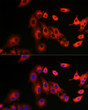 Immunofluorescence analysis of A-549 cells using SQSTM1/p62 Rabbit polyclonal antibody (STJ11104488) at dilution of 1:100 (40x lens). Secondary antibody: Cy3 Goat Anti-Rabbit IgG (H+L) at 1:500 dilution. Blue: DAPI for nuclear staining.