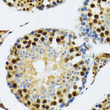 Immunohistochemistry analysis of paraffin-embedded rat testis using TXNL1 antibody (STJ11104492) at dilution of 1:100 (40x lens). Perform microwave antigen retrieval with 10 mM PBS buffer pH 7. 2 before commencing with immunohistochemistry staining protocol.