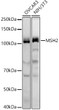 Western blot analysis of extracts of various cell lines, using MSH2 antibody (STJ11104510) at 1:1000 dilution. Secondary antibody: HRP Goat Anti-Rabbit IgG (H+L) (STJS000856) at 1:10000 dilution. Lysates/proteins: 25 Mu g per lane. Blocking buffer: 3% nonfat dry milk in TBST. Detection: ECL Basic Kit. Exposure time: 30s. Western blot analysis of extracts of various cell lines, using MSH2 antibody (STJ11104510) at 1:1000 dilution. Secondary antibody: HRP Goat Anti-Rabbit IgG (H+L) (STJS000856) at 1:10000 dilution. Lysates/proteins: 25 Mu g per lane. Blocking buffer: 3% nonfat dry milk in TBST. Detection: ECL Basic Kit. Exposure time: 30s.