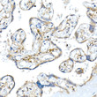 Immunohistochemistry analysis of Podoplanin in paraffin-embedded human placenta using Podoplanin Rabbit polyclonal antibody (STJ11104515) at dilution of 1:20 (40x lens). Perform high pressure antigen retrieval with 10 mM citrate buffer pH 6. 0 before commencing with immunohistochemistry staining protocol.