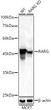 Western blot analysis of extracts from wild type (WT) and RARG knockdown (KD) MCF7 cells, using RARG antibody (STJ11104541) at 1:1000 dilution. Secondary antibody: HRP Goat Anti-Rabbit IgG (H+L) (STJS000856) at 1:10000 dilution. Lysates/proteins: 25 Mu g per lane. Blocking buffer: 3% nonfat dry milk in TBST. Detection: ECL Enhanced Kit. Exposure time: 90s.