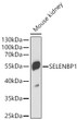 Western blot analysis of lysates from Mouse kidney using SELENBP1 Rabbit polyclonal antibody (STJ11104553) at 1:1000 dilution. Secondary antibody: HRP Goat Anti-Rabbit IgG (H+L) (STJS000856) at 1:10000 dilution. Lysates/proteins: 25  Mu g per lane. Blocking buffer: 3% nonfat dry milk in TBST. Detection: ECL Basic Kit. Exposure time: 90s.