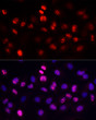 Immunofluorescence analysis of HeLa cells using Ki67 Rabbit monoclonal antibody (STJ11104589) at dilution of 1:100 (40x lens). Secondary antibody: Cy3 Goat Anti-Rabbit IgG (H+L) at 1:500 dilution. Blue: DAPI for nuclear staining.
