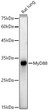 Western blot analysis of extracts of Rat lung, using MyD88 antibody (STJ11104598) at1:2000 dilution. Secondary antibody: HRP Goat Anti-Rabbit IgG (H+L) (STJS000856) at1:10000 dilution. Lysates/proteins: 25 Mu g per lane. Blocking buffer: 3% nonfat dry milk in TBST. Detection: ECL Enhanced Kit. Exposure time: 90s.