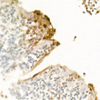 Immunohistochemistry analysis of paraffin-embedded human tonsil using S100A7/Psoriasin Rabbit polyclonal antibody (STJ11104670) at dilution of 1:200 (40x lens). Perform high pressure antigen retrieval with 10 mM citrate buffer pH 6. 0 before commencing with immunohistochemistry staining protocol.