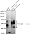 Western blot analysis of extracts of various cell lines, using CD132/IL-2 R gamma antibody (STJ11104677) at1:2000 dilution. Secondary antibody: HRP Goat Anti-Rabbit IgG (H+L) (STJS000856) at 1:10000 dilution. Lysates/proteins: 25 Mu g per lane. Blocking buffer: 3% nonfat dry milk in TBST. Detection: ECL Enhanced Kit. Exposure time: 60s.