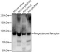 Western blot analysis of extracts of various cell lines, using Progesterone Receptor antibody (STJ11104690) at 1:10000 dilution. Secondary antibody: HRP Goat Anti-Rabbit IgG (H+L) (STJS000856) at 1:10000 dilution. Lysates/proteins: 25 Mu g per lane. Blocking buffer: 3% nonfat dry milk in TBST. Detection: ECL Enhanced Kit. Exposure time: 180s.