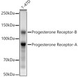 Western blot analysis of extracts of T-47D cells, using Progesterone Receptor antibody (STJ11104690) at 1:10000 dilution. Secondary antibody: HRP Goat Anti-Rabbit IgG (H+L) (STJS000856) at 1:10000 dilution. Lysates/proteins: 25 Mu g per lane. Blocking buffer: 3% nonfat dry milk in TBST. Detection: ECL Basic Kit. Exposure time: 4s.