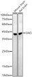 Western blot analysis of extracts of various cell lines, using DAO antibody (STJ11104697) at1:20000 dilution. Secondary antibody: HRP Goat Anti-Rabbit IgG (H+L) (STJS000856) at 1:10000 dilution. Lysates/proteins: 25 Mu g per lane. Blocking buffer: 3% nonfat dry milk in TBST. Detection: ECL Enhanced Kit. Exposure time: 60s.