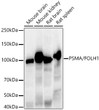Western blot analysis of various lysates, using PSMA/FOLH1 antibody (STJ11104752) at1:20000 dilution. Secondary antibody: HRP Goat Anti-Rabbit IgG (H+L) (STJS000856) at 1:2000000 dilution. Lysates/proteins: 25 Mu g per lane. Blocking buffer: 3% nonfat dry milk in TBST. Detection: ECL Enhanced Kit. Exposure time: 30s.