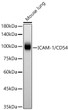 Western blot analysis of lysates from Mouse lung using ICAM-1/CD54 Rabbit monoclonal antibody (STJ11104758) at 1:10000 dilution. Secondary antibody:HRP Goat Anti-Rabbit IgG (H+L) (STJS000856) at 1:10000 dilution. Lysates/proteins: 25  Mu g per lane. Blocking buffer: 3% nonfat dry milk in TBST. Detection:ECL Basic Kit. Exposuretime:5s.