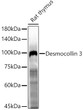 Western blot analysis of Rat thymus, using Desmocollin3 antibody (STJ11104759) at 1:500 dilution. Secondary antibody: HRP Goat Anti-Rabbit IgG (H+L) (STJS000856) at 1:10000 dilution. Lysates/proteins: 25 Mu g per lane. Blocking buffer: 3% nonfat dry milk in TBST. Detection: ECL Enhanced Kit. Exposure time: 180s.