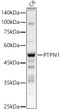 Western blot analysis of lysates from C6 cells, using [KO Validated] PTPN1 Rabbit polyclonal antibody (STJ11104770) at 1:600 dilution. Secondary antibody: HRP Goat Anti-Rabbit IgG (H+L) (STJS000856) at 1:10000 dilution. Lysates/proteins: 25 Mu g per lane. Blocking buffer: 3% nonfat dry milk in TBST. Detection: ECL Basic Kit. Exposure time: 1s.