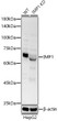 Western blot analysis of extracts from normal (control) and knockdown (KD) HepG2 cells, using ZEB1 antibody (STJ11104772) at 1:1000 dilution. Secondary antibody: HRP Goat Anti-Rabbit IgG (H+L) (STJS000856) at 1:10000 dilution. Lysates/proteins: 25 Mu g per lane. Blocking buffer: 3% nonfat dry milk in TBST. Detection: ECL Basic Kit. Exposure time: 10s.