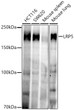 Western blot analysis of various lysates, using LRP5 Rabbit monoclonal antibody (STJ11104803) at 1:1000 dilution. Secondary antibody: HRP Goat Anti-Rabbit IgG (H+L) (STJS000856) at 1:10000 dilution. Lysates/proteins: 25 Mu g per lane. Blocking buffer: 3% nonfat dry milk in TBST. Detection: ECL Enhanced Kit. Exposure time: 180s.