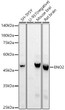 Western blot analysis of various lysates, using ENO2 antibody (STJ11104813) at 1:2000 dilution. Secondary antibody: HRP Goat Anti-Rabbit IgG (H+L) (STJS000856) at 1:10000 dilution. Lysates/proteins: 25 Mu g per lane. Blocking buffer: 3% nonfat dry milk in TBST. Detection: ECL Basic Kit. Exposure time: 3s.