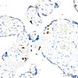 Immunohistochemistry analysis of Cyclin E1 in paraffin-embedded human placenta using Cyclin E1 Rabbit monoclonal antibody (STJ11104815) at dilution of 1:100 (40x lens). Perform high pressure antigen retrieval with 10 mM citrate buffer pH 6. 0 before commencing with immunohistochemistry staining protocol.
