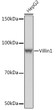 Western blot analysis of extracts of HepG2 cells, using Villin1 Rabbit monoclonal antibody (STJ11104839) at 1:1000 dilution. Secondary antibody: HRP Goat Anti-Rabbit IgG (H+L) (STJS000856) at 1:10000 dilution. Lysates/proteins: 25 Mu g per lane. Blocking buffer: 3% nonfat dry milk in TBST. Detection: ECL Basic Kit. Exposure time: 1s.