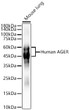 Western blot analysis of lysates from Mouse lung using Human AGER Rabbit polyclonal antibody (STJ11104862) at 1:700 dilution. Secondary antibody: HRP Goat Anti-Rabbit IgG (H+L) (STJS000856) at 1:10000 dilution. Lysates/proteins: 25  Mu g per lane. Blocking buffer: 3% nonfat dry milk in TBST. Detection: ECL Basic Kit. Exposure time:0. 1s.