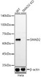Western blot analysis of lysates from wild type (WT) and SMAD2 knockout (KO) Hela (KO) cells, using [KO Validated] Smad2 Rabbit monoclonal antibody (STJ11104898) at 1:500 dilution. Secondary antibody: HRP Goat Anti-Rabbit IgG (H+L) (STJS000856) at 1:10000 dilution. Lysates/proteins: 25 Mu g per lane. Blocking buffer: 3% nonfat dry milk in TBST. Detection: ECL Basic Kit. Exposure time: 180s.