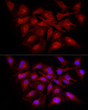 Immunofluorescence analysis of HeLa cells using RELA Rabbit polyclonal antibody (STJ11104914) at dilution of 1:100 (40x lens). Blue: DAPI for nuclear staining.