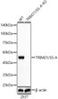 Western blot analysis of extracts from wild type (WT) and TRIM21/SS-A knockout (KO) 293T (KO) cells, using TRIM21/SS-A antibody (STJ11104930) at 1:2000 dilution. Secondary antibody: HRP Goat Anti-Rabbit IgG (H+L) (STJS000856) at 1:10000 dilution. Lysates/proteins: 25 Mu g per lane. Blocking buffer: 3% nonfat dry milk in TBST. Detection: ECL Basic Kit. Exposure time: 60s.