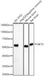 Western blot analysis of various lysates, using AKT3 antibody (STJ11104934) at 1:60000 dilution. Secondary antibody: HRP Goat Anti-Rabbit IgG (H+L) (STJS000856) at 1:10000 dilution. Lysates/proteins: 25 Mu g per lane. Blocking buffer: 3% nonfat dry milk in TBST. Detection: ECL Basic Kit. Exposure time: 180s.