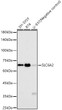 Western blot analysis of various lysates, using SLC6A2 Rabbit monoclonal antibody (STJ11104951) at 1:16000 dilution. Secondary antibody: HRP Goat Anti-Rabbit IgG (H+L) (STJS000856) at 1:10000 dilution. Lysates/proteins: 25 Mu g per lane. Blocking buffer: 3% nonfat dry milk in TBST. Detection: ECL Basic Kit. Exposure time: 180s.