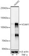 Western blot analysis of HUVEC, using VCAM1 Rabbit monoclonal antibody (STJ11105093) at 1:1000 dilution. HUVEC cells were treated by TNF-Alpha (20 ng/ml) at 37 °C for 30 minutes. Secondary antibody: HRP Goat Anti-Rabbit IgG (H+L) (STJS000856) at 1:10000 dilution. Lysates/proteins: 25 Mu g per lane. Blocking buffer: 3% nonfat dry milk in TBST. Detection: ECL Basic Kit. Exposure time: 180s.