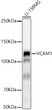 Western blot analysis of U-138MG, using VCAM1 Rabbit monoclonal antibody (STJ11105093) at 1:1000 dilution. Secondary antibody: HRP Goat Anti-Rabbit IgG (H+L) (STJS000856) at 1:10000 dilution. Lysates/proteins: 25 Mu g per lane. Blocking buffer: 3% nonfat dry milk in TBST. Detection: ECL Basic Kit. Exposure time: 180s.