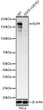 Western blot analysis of lysates from wild type (WT) and EGFR knockdown (KD) HeLa cells, using [KD Validated] EGFR Rabbit monoclonal antibody (STJ11105117) at 1:1000 dilution. Secondary antibody: HRP Goat Anti-Rabbit IgG (H+L) (STJS000856) at 1:10000 dilution. Lysates/proteins: 25 Mu g per lane. Blocking buffer: 3% nonfat dry milk in TBST. Detection: ECL Basic Kit. Exposure time: 30s.