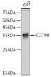 Western blot analysis of lysates from Raji cells, using CD79B Rabbit monoclonal antibody (STJ11105118) at 1:1000 dilution. Secondary antibody: HRP Goat Anti-Rabbit IgG (H+L) (STJS000856) at 1:10000 dilution. Lysates/proteins: 25 Mu g per lane. Blocking buffer: 3% nonfat dry milk in TBST. Detection: ECL Basic Kit. Exposure time: 1s.