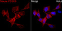 Immunofluorescence analysis of HeLa cells using PCSK9 Rabbit polyclonal antibody (STJ11105145) at a dilution of 1:200 (40x lens). Secondary antibody:Cy3 Goat Anti-Rabbit IgG (H+L) at 1:500 dilution. Blue: DAPI for nuclear staining.