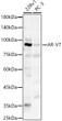 Western blot analysis of various lysates, using AR-V7 Rabbit polyclonal antibody (STJ11105166) at 1:3000 dilution. Secondary antibody: HRP Goat Anti-Rabbit IgG (H+L) (STJS000856) at 1:10000 dilution. Lysates/proteins: 25 Mu g per lane. Blocking buffer: 3% nonfat dry milk in TBST. Detection: ECL Basic Kit. Exposure time: 90s.