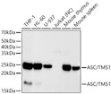 Western blot analysis of various lysates using ASC/TMS1 Rabbit monoclonal antibody (STJ11105198) at 1:20000 dilution. Secondary antibody: HRP Goat Anti-Rabbit IgG (H+L) (STJS000856) at 1:10000 dilution. Lysates/proteins: 25  Mu g per lane. Blocking buffer: 3% nonfat dry milk in TBST. Detection: ECL Basic Kit. Negative control (NC) : Jurkat. Exposure time: 180s.