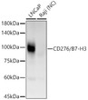 Western blot analysis of various lysates, using CD276/B7-H3 Rabbit monoclonal antibody (STJ11105227) at 1:1000 dilution. Secondary antibody: HRP Goat Anti-Rabbit IgG (H+L) (STJS000856) at 1:10000 dilution. Lysates/proteins: 25 Mu g per lane. Blocking buffer: 3% nonfat dry milk in TBST. Detection: ECL Basic Kit. Negative control (NC) : RajiExposure time: 90s.