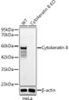 Western blot analysis of lysates from wild type (WT) and Cytokeratin 8 knockout (KO) HeLa cells, using Cytokeratin 8 Rabbit polyclonal antibody (STJ11105320) at 1:1000 dilution. Secondary antibody: HRP Goat Anti-Rabbit IgG (H+L) (STJS000856) at 1:10000 dilution. Lysates/proteins: 25ug per lane. Blocking buffer: 3% nonfat dry milk in TBST. Detection: ECL Basic Kit. Exposure time: 0. 5s.